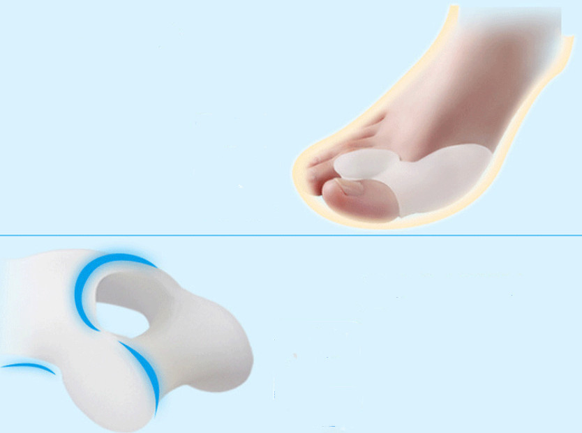 Unisex Toe Corrector Halux Valgus Splint Bunion Relief Straightener Foot Care