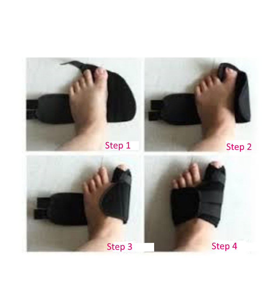 Bunion Splints Foot Big Toe Pain Relief Hallux Valgus Splint Brace – PAIR