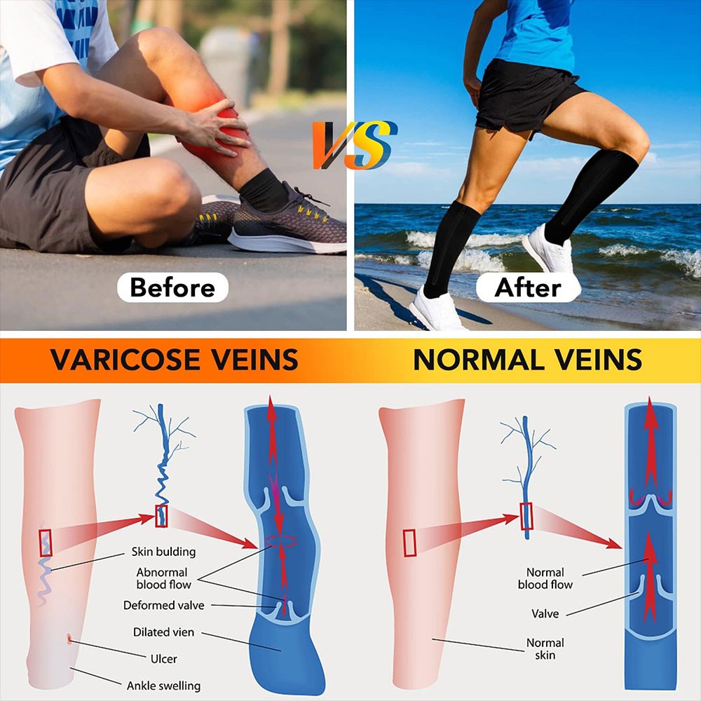 Zipper Open Toe Compression Socks 20-30mmHg Calf Leg Ankle Support Stocking