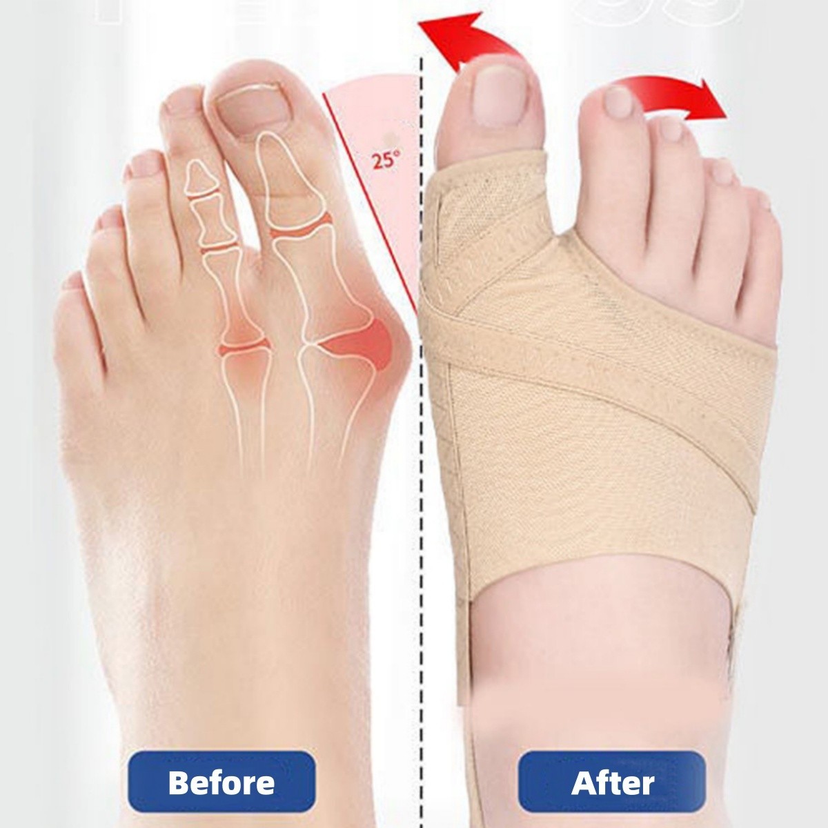 Big Toe Bunion Corrector Splint Straightener Foot Pain Relief Hallux Valgus US