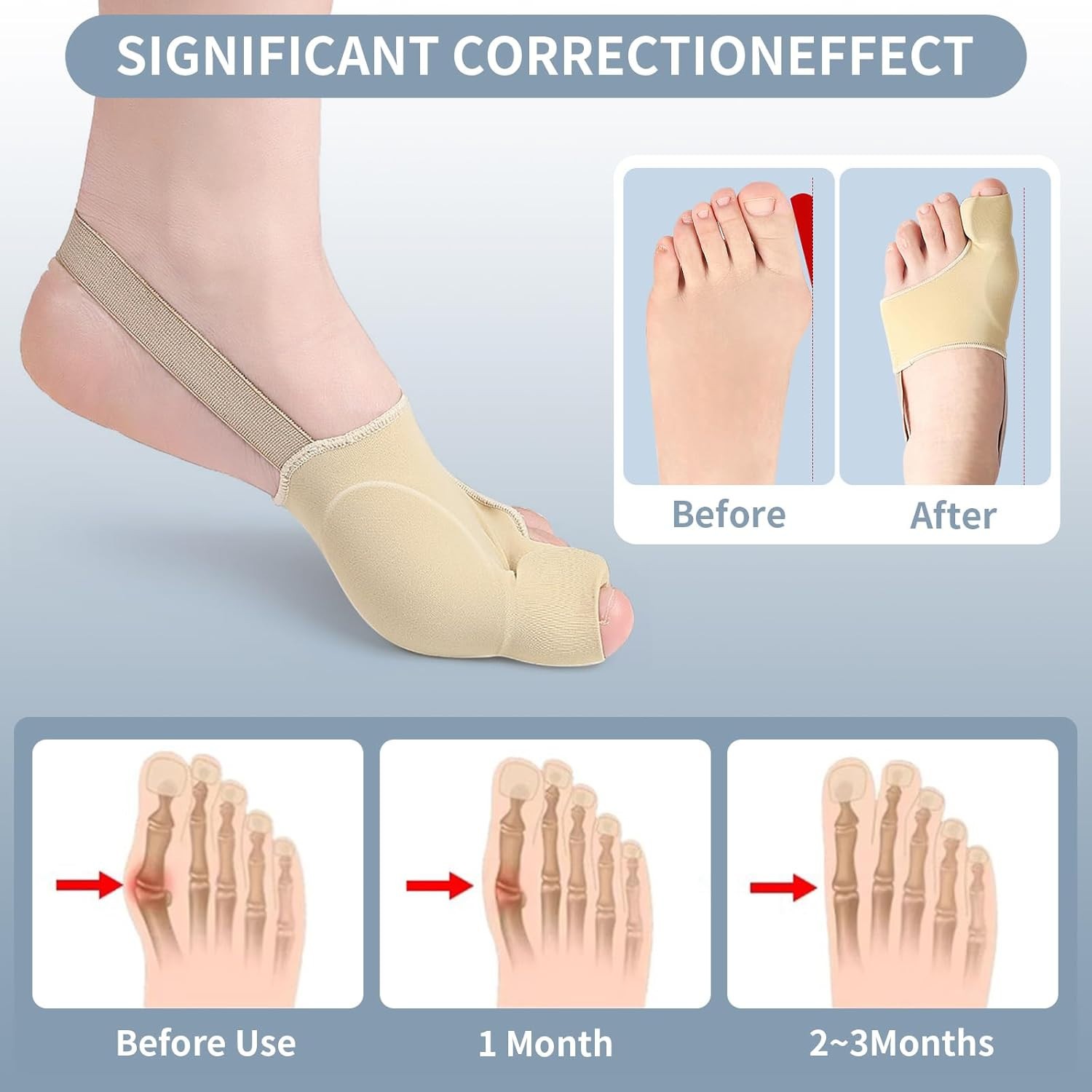 DFQ 2 Pcs Bunion Corrector Split for Women & Men Big Toe Straightener Beige NEW