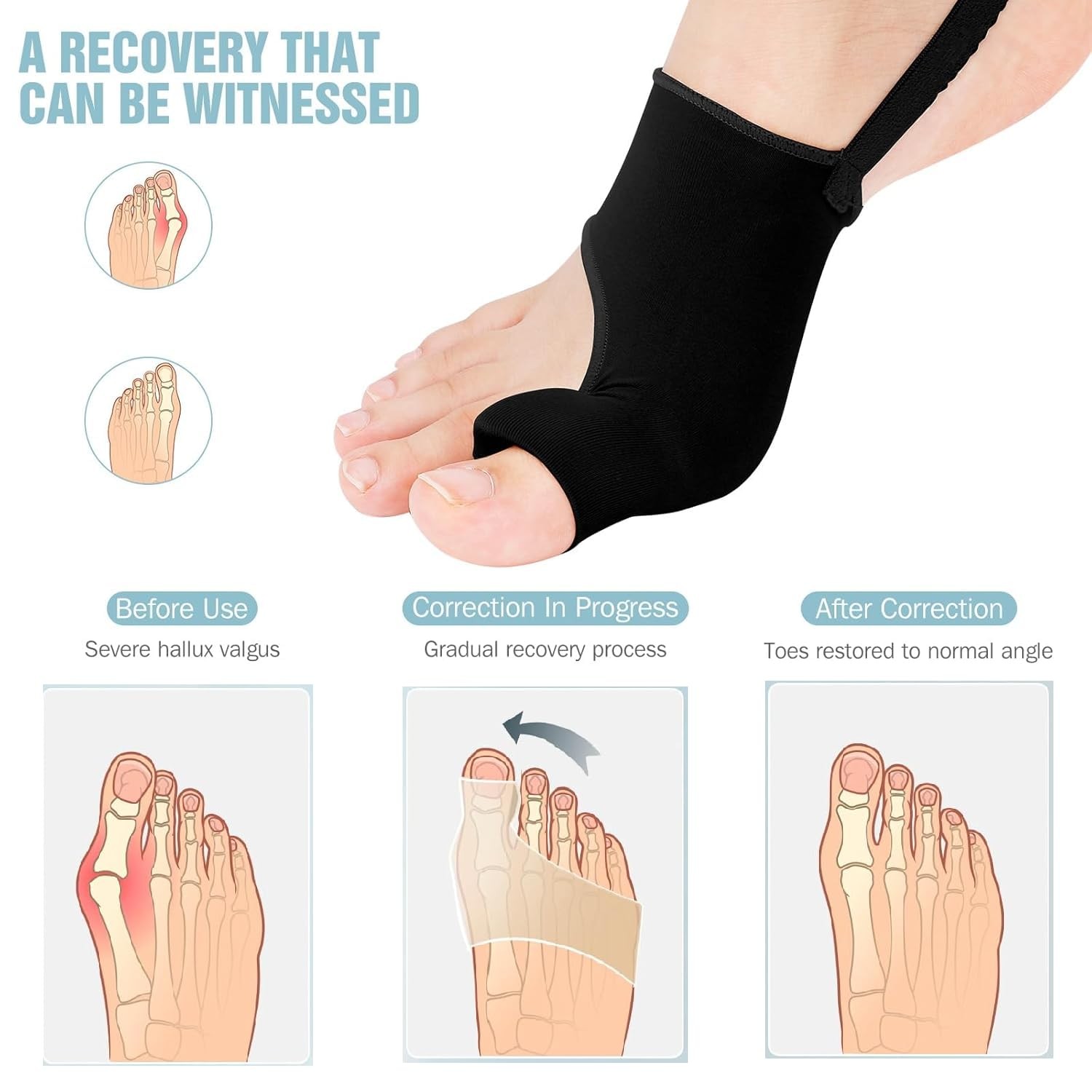 WELEQUT 2PCS Bunion Corrector for Women & Men – Toe Alignment Medium, Black