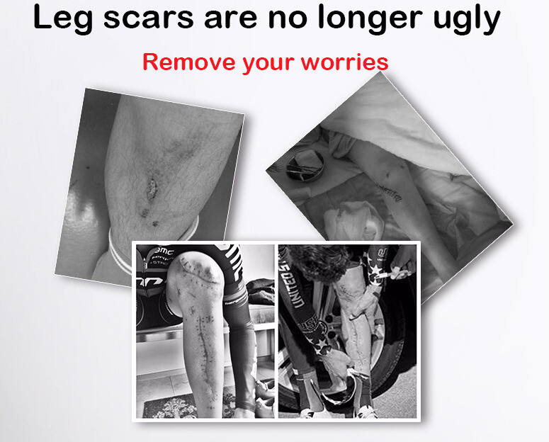 Highly Simulated Skin Artificial Silicone Prosthesis Foot Sleeve Leg Cover Scars