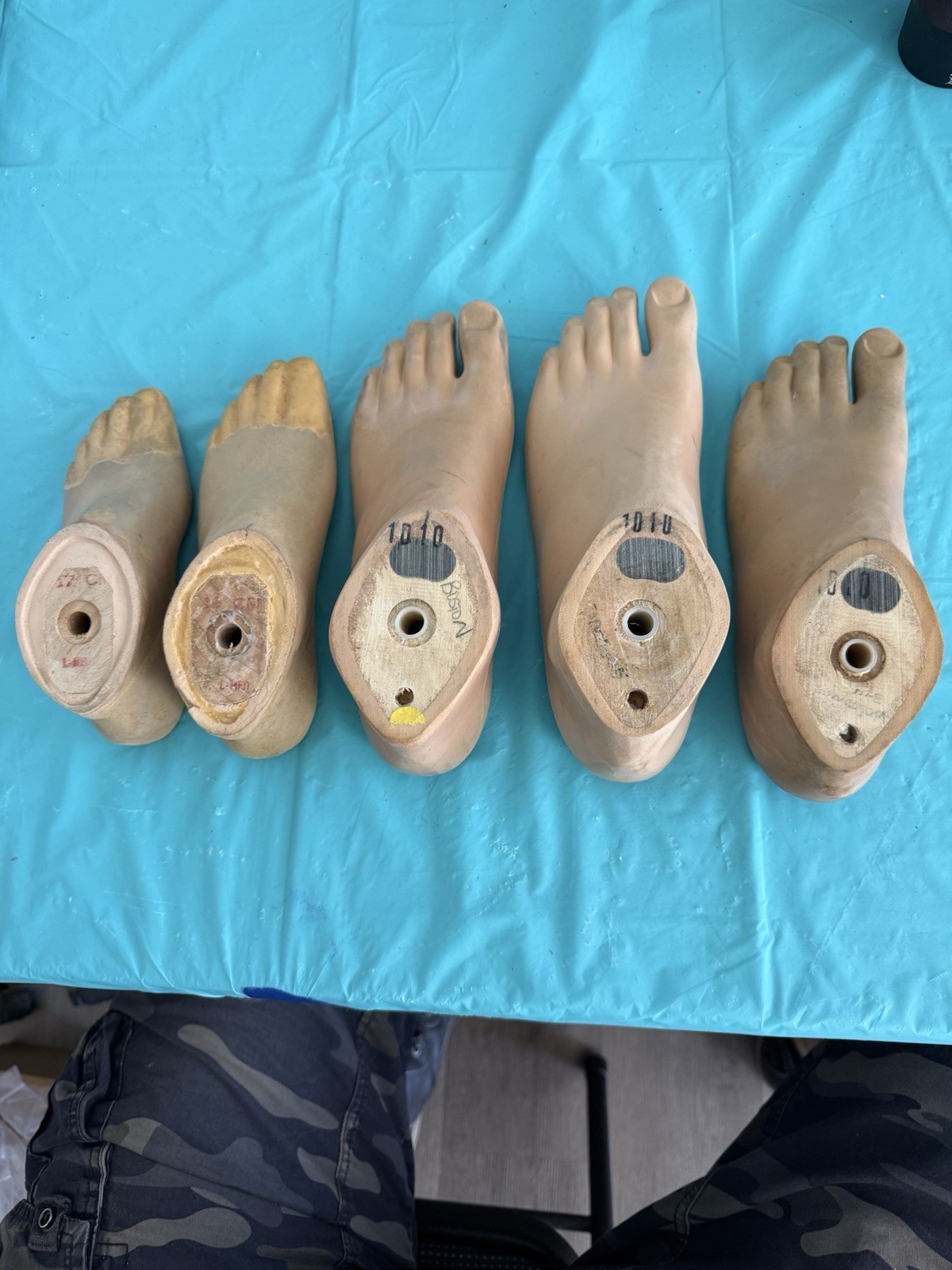 lot of 5 USED PROSTHETIC FEET. 3 OTTO BOCK -2 KINGSLEY JUVENILE