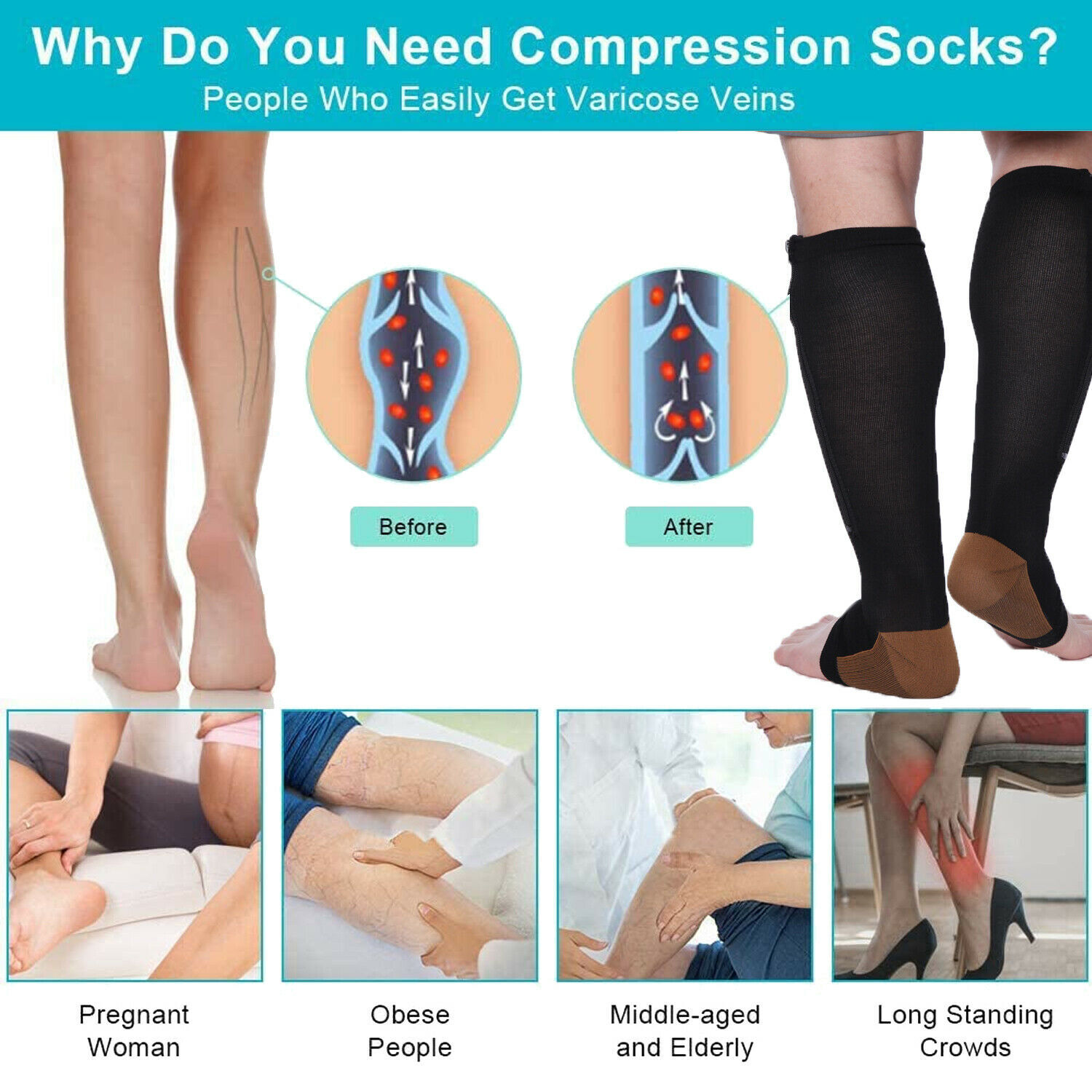 Zipper Compression Socks Open Toe for Men Women Knee High Support Hose 20-30mmHg