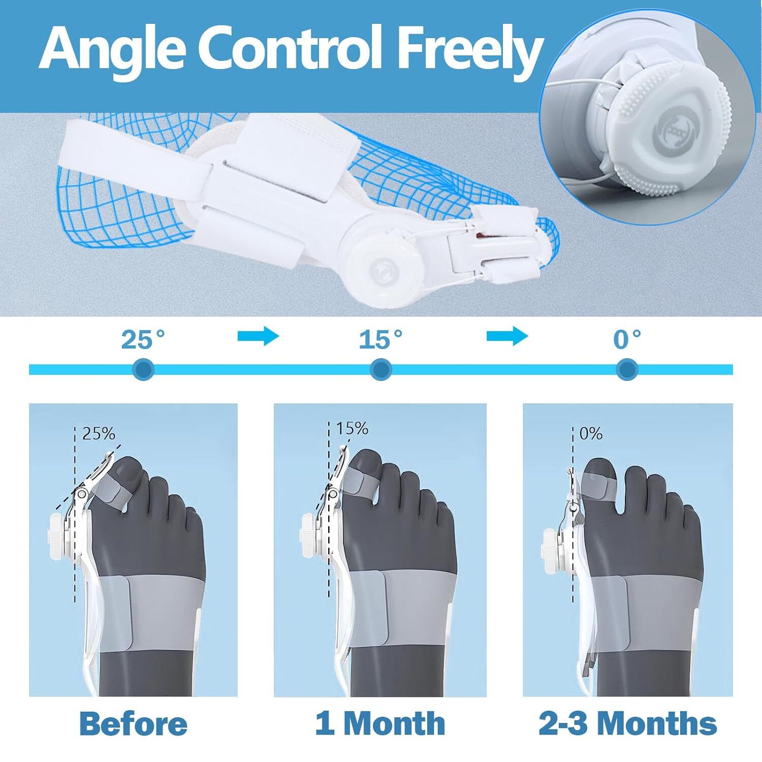 Bunion Corrector Orthopedic Bunion Big Toe Straightener Splint Bunion Relief US