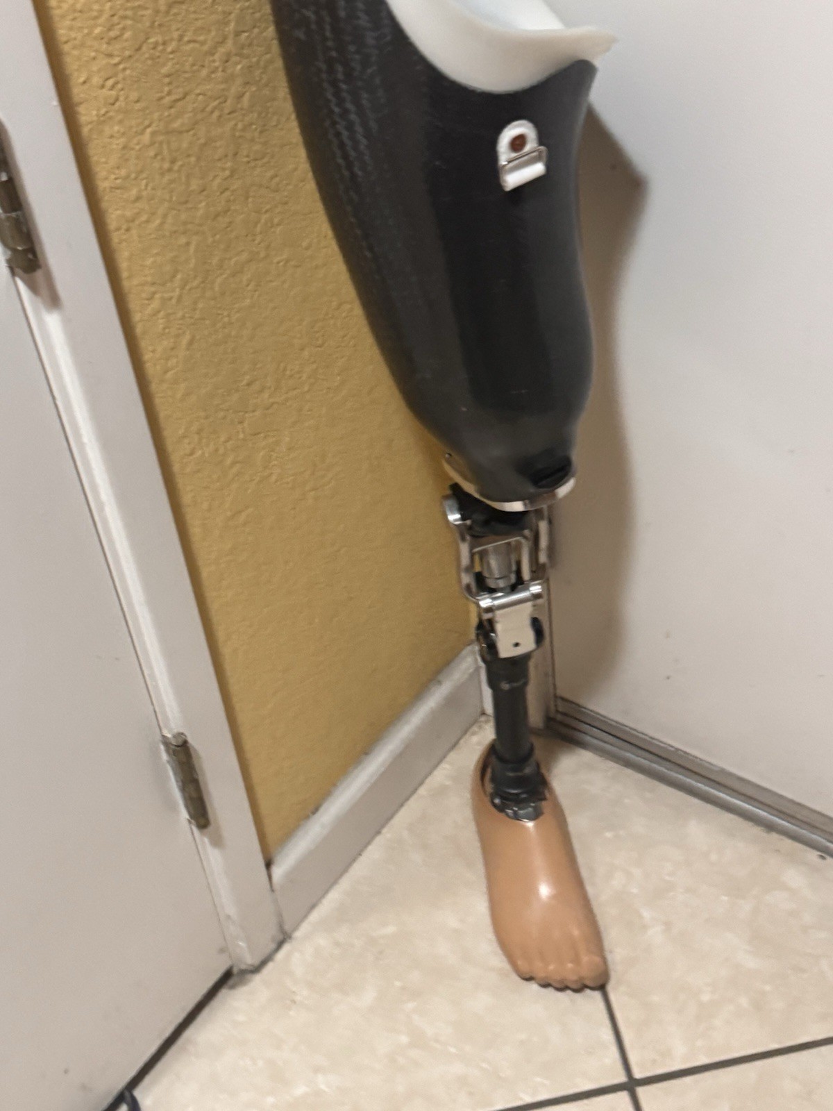 Complete Above-Knee Right Prosthetic Leg. Trulife, Ossure, Kiss, Lapoc/Swan