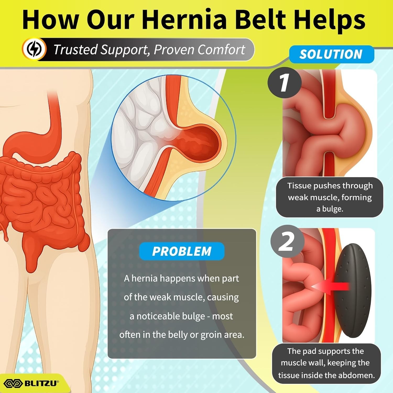 BLITZU Umbilical Hernia Belt for Men & Women, Abdominal Binder Adjustable Truss