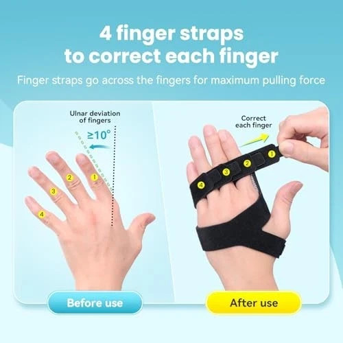 Finger Ulnar Deviation Splint Brace, Finger Joint Deviation Right-M Black
