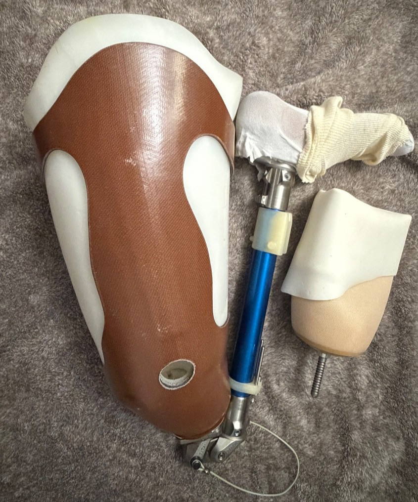 Vintage Ottobock Titan Left – Above the knee with Original Stub