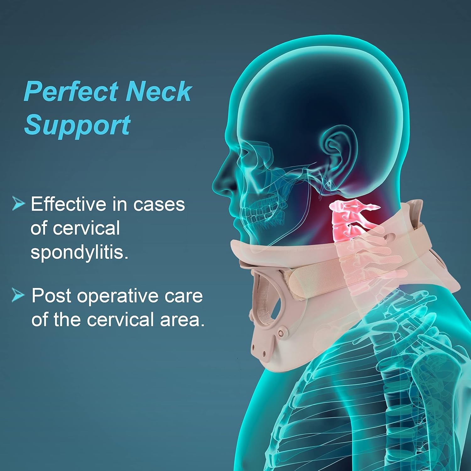 TYNOR Cervical Orthosis (Philadelphia) Ethafoam Relief In Cervical Spondylitis