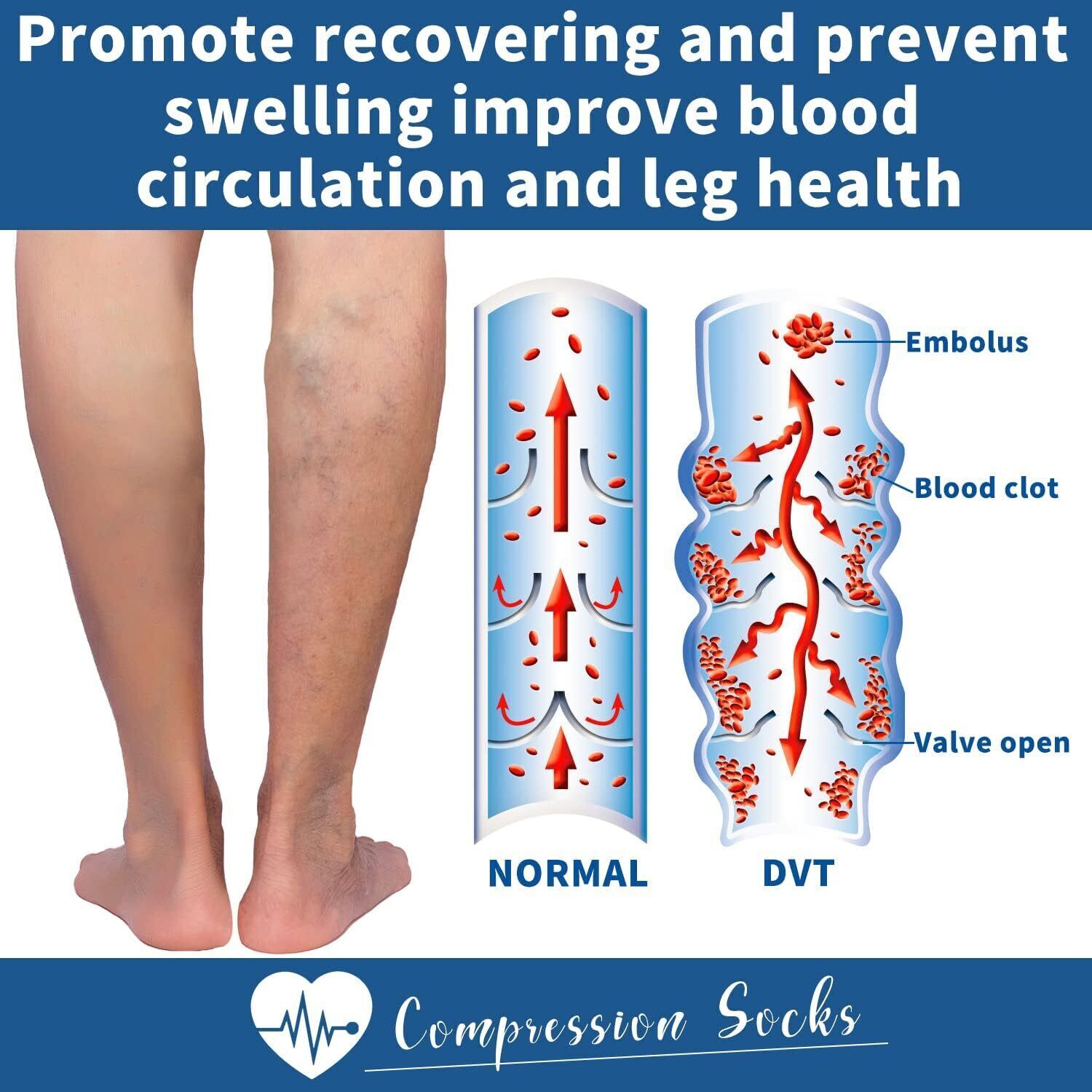 Compression Socks Open toe Toeless 3 Pairs for Women& Men 15-20 mmHg Knee High