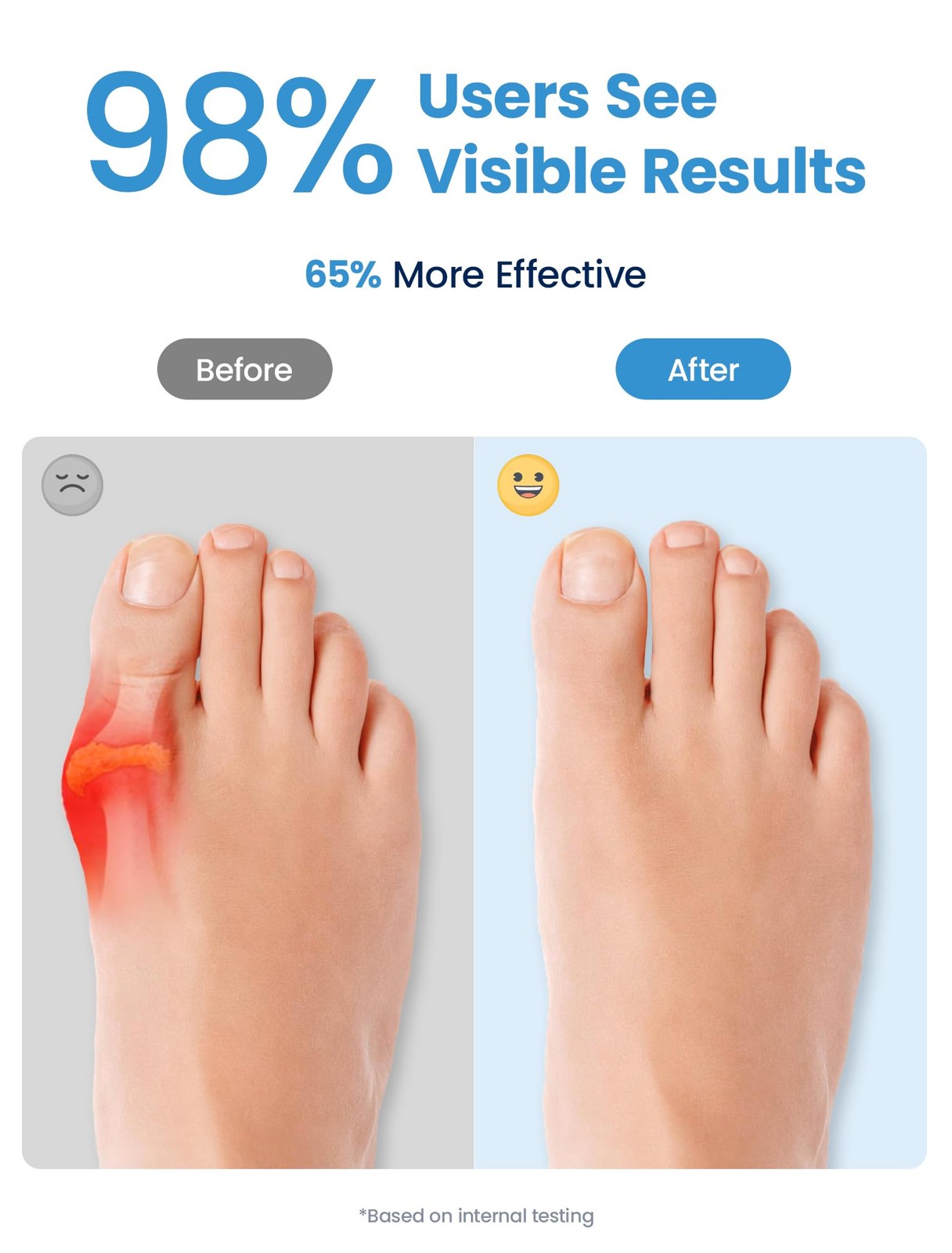 Habioer Bunion Corrector, Toe Separators for Women and One Size, Light Blue