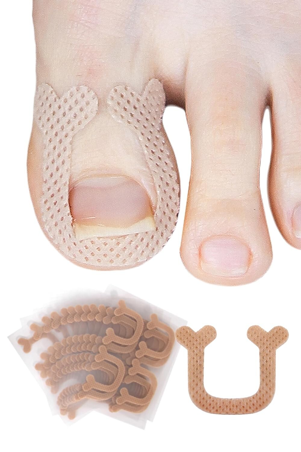Pincher / Pro Band Penetrating Resistant Ingrown Toenail Corrector Strips 52 p