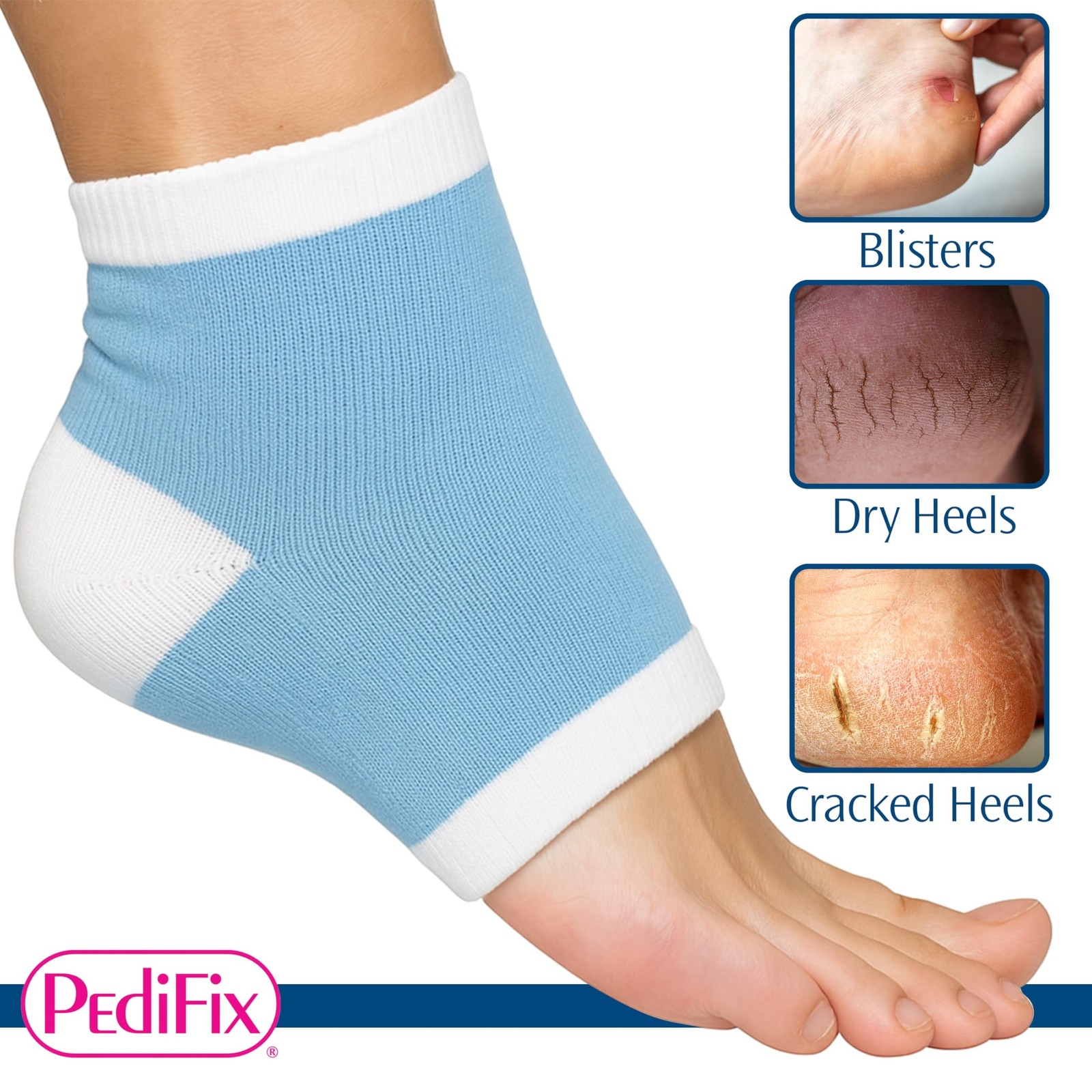 PediFix Visco-Gel Heel-So-Smooth Heel Sleeves – One Size Fits Most