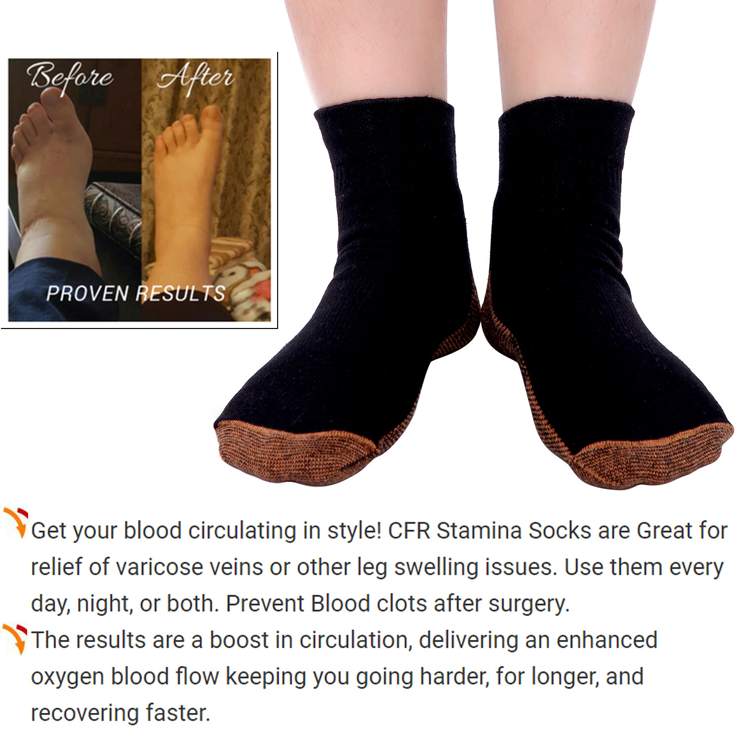 COMFREE Copper Sleeve Compression Socks Plantar Fasciitis Ankle Foot Pain Relief