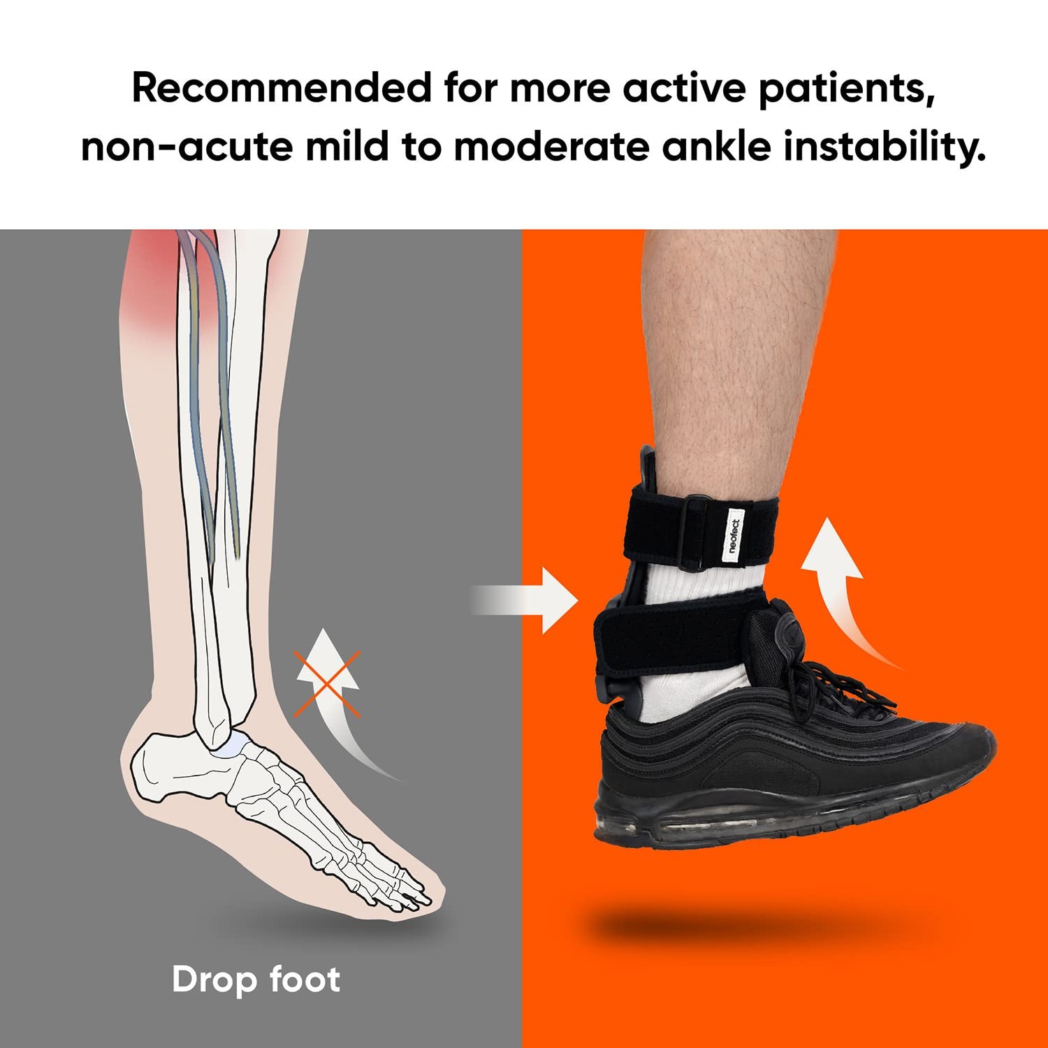 Neofect STEP Small Left AFO Foot Drop Brace, Drop Foot Brace for Walking, Ank…