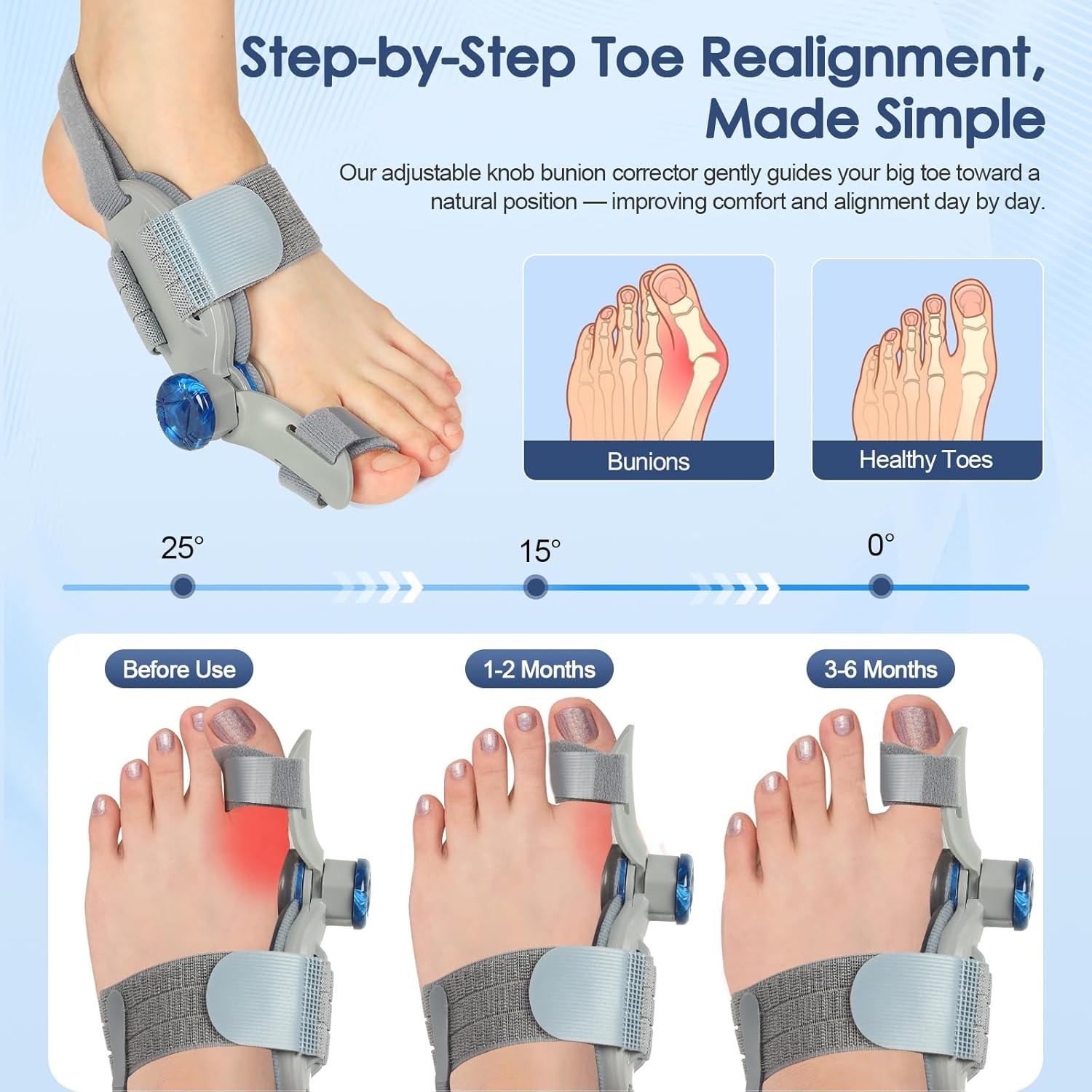 2x Bunion Fix Toe Valgus Corrector Adjustable Orthopedic Splints for Left Right