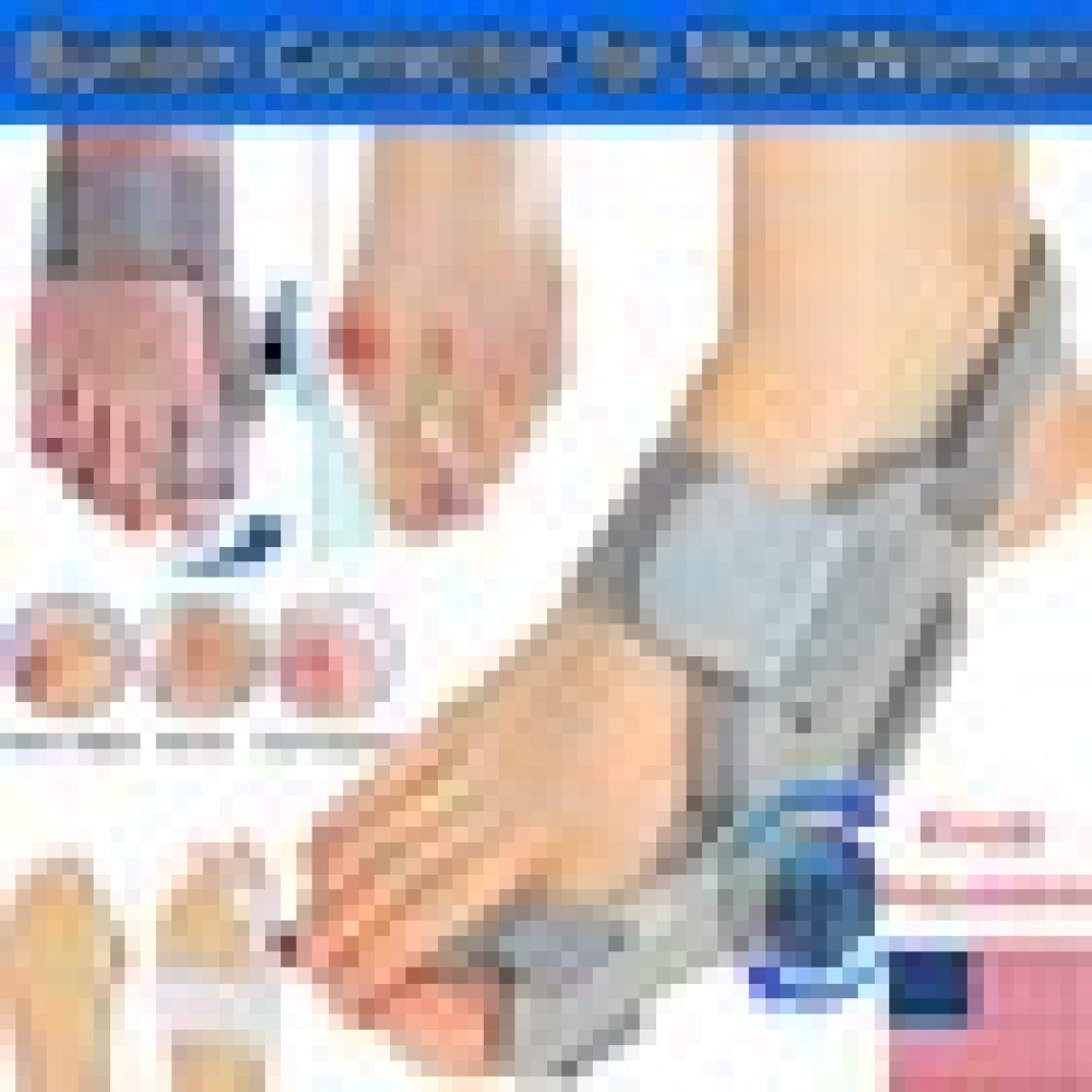Ergonomics Bunion Fix Toe Valgus Corrector Adjustable Orthosis Women Men Splints