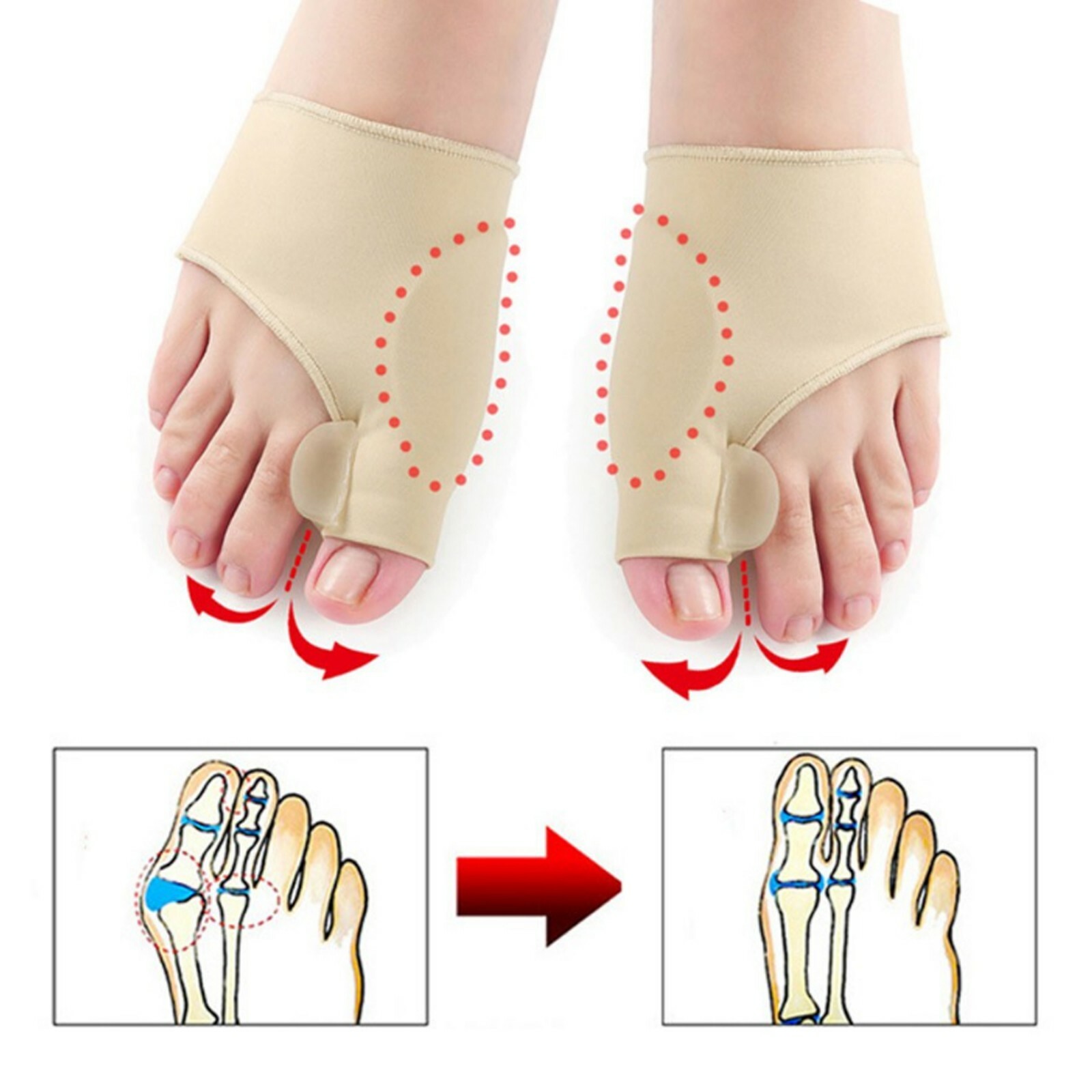 AdorePro Big Toe Separator Bunion Corrector Splint Straightener Foot Pain Relief