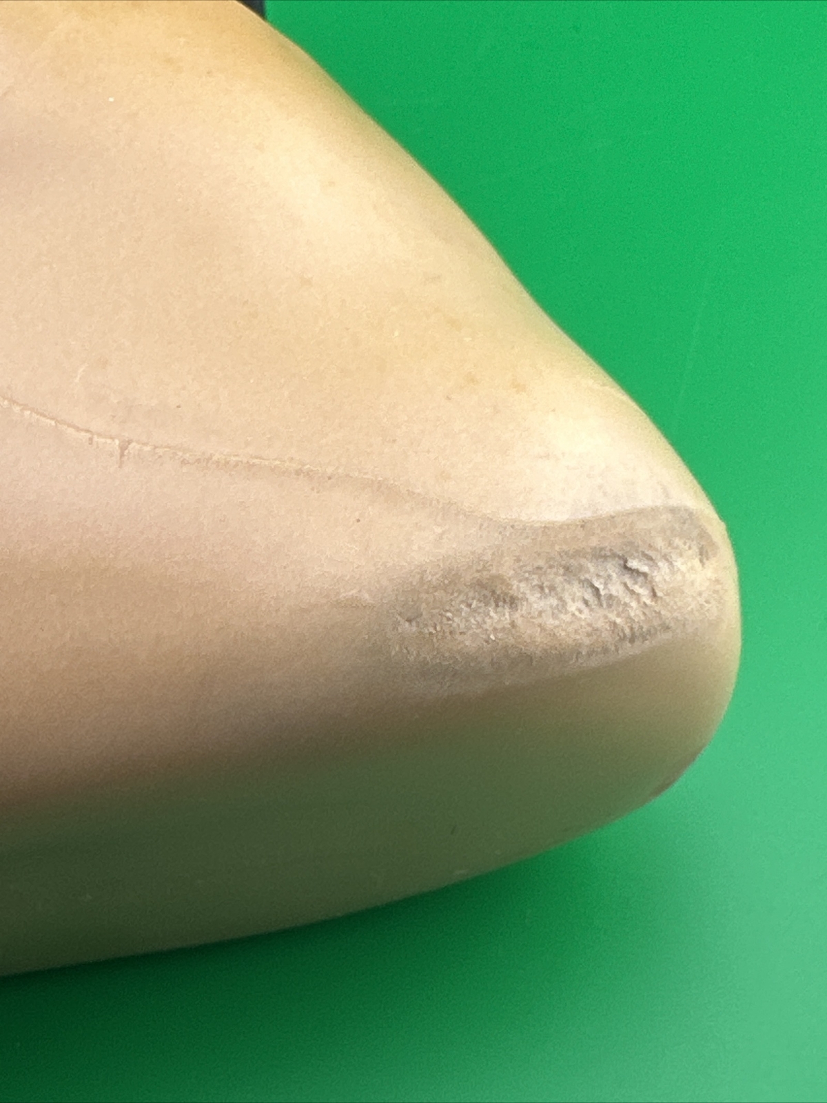 Ottobock Otto Bock Taleo Vertical Prosthetic Foot. 1C51 Prosthetic Foot