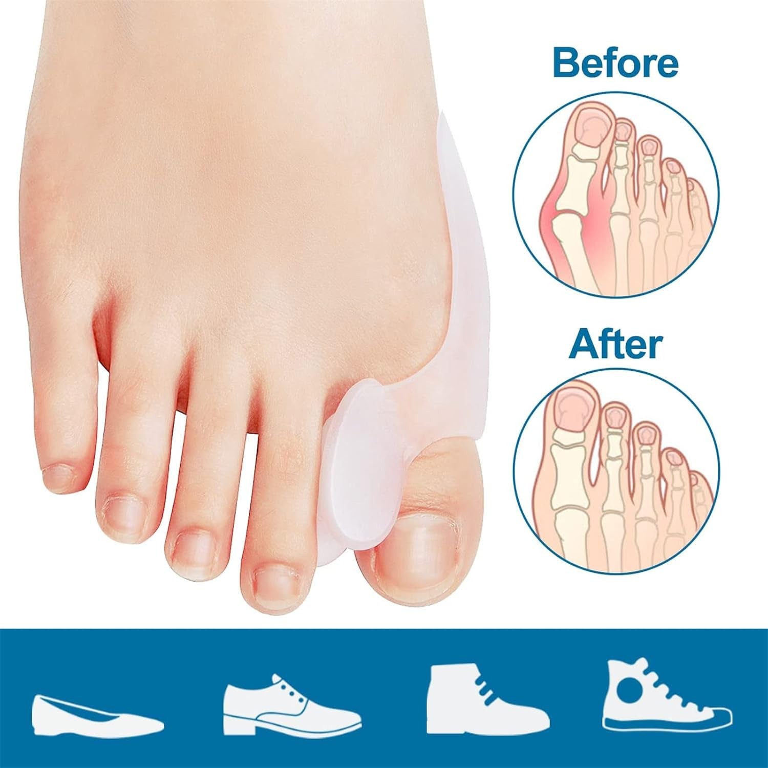 12 bunion cushion protectors, bunion pads, correctors, toe spreaders the big toe