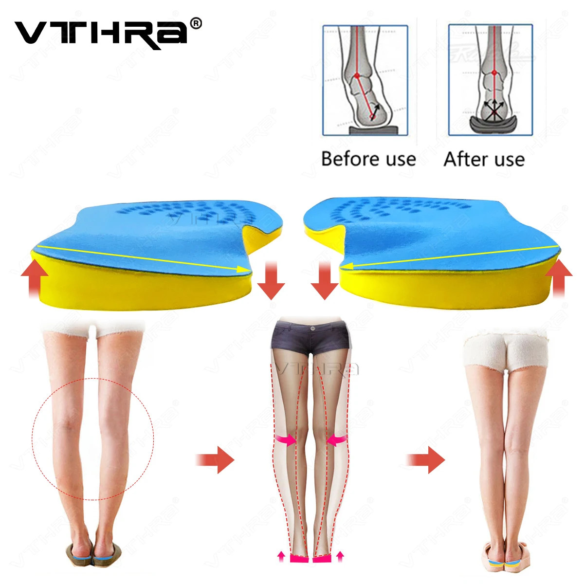 O/X Leg Orthopedic Insoles Correction Shoes Inserts For Foot Alignment Kno