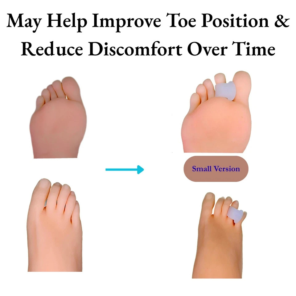 Corrector Hallux Valgus Bunion Toe Splint Straightener Big Foot Support Gel Pad