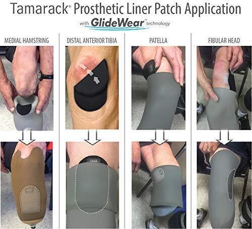 GlideWear Prosthetic Liner Patch for Amputees (2 Pack)