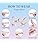 Oval Finger Splint 8 pcs, Finger Splints for Arthritis, Mallet Finger, Trigger F