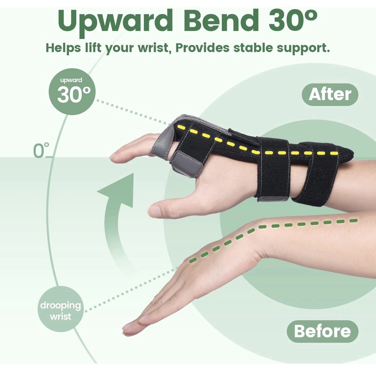 Dr Finger Radial Nerve Palsy Splint/Brace Wrist Drop, Adjustable, Fits R & L