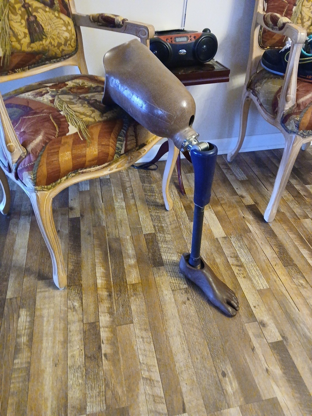 prosthetic leg above knee