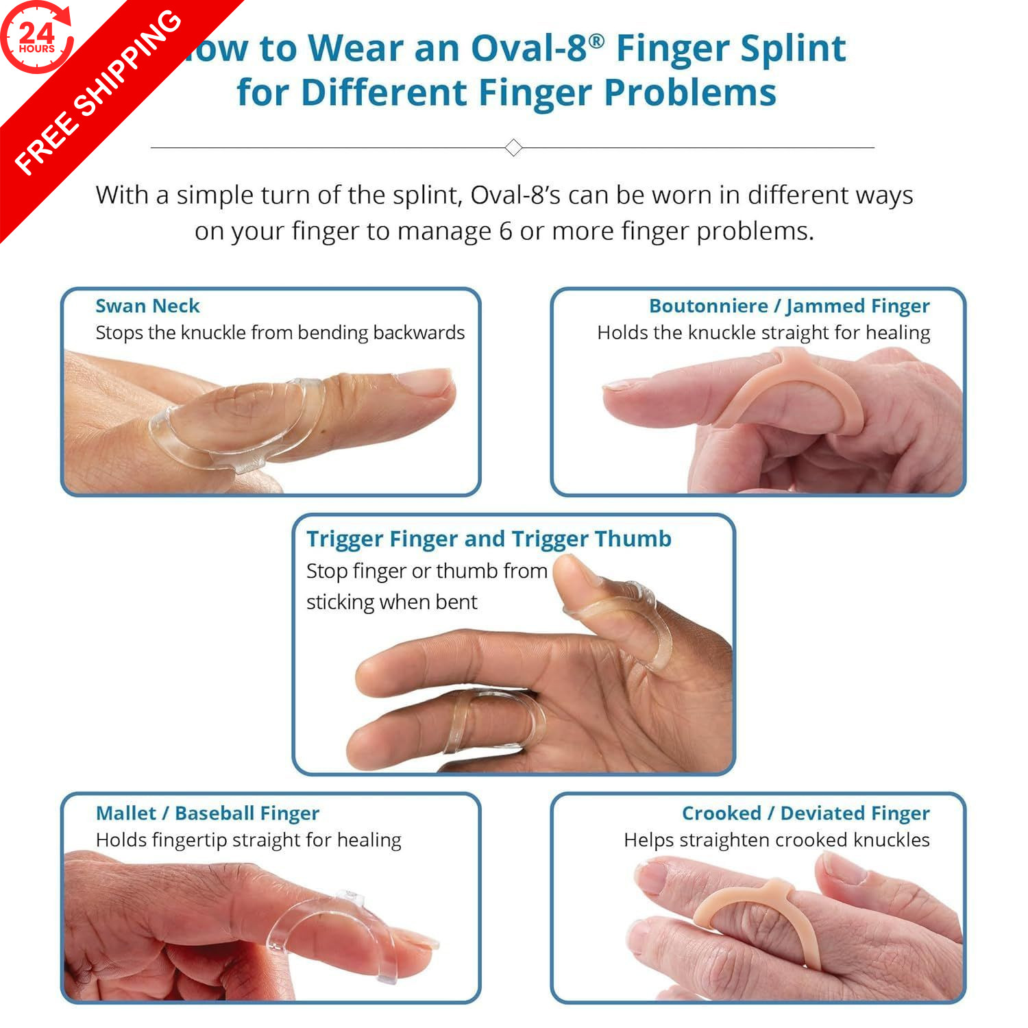 3-Point Products Oval-8 Finger Splints, Sizes 8, 9, 3 Piece Assortment, beige