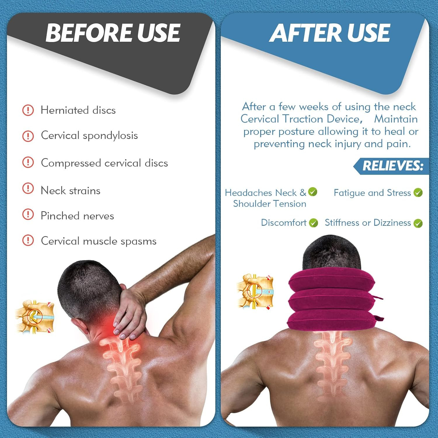 Neck Stretcher, Neck Traction Device for Instant Neck Pain Relief | Adjustable I