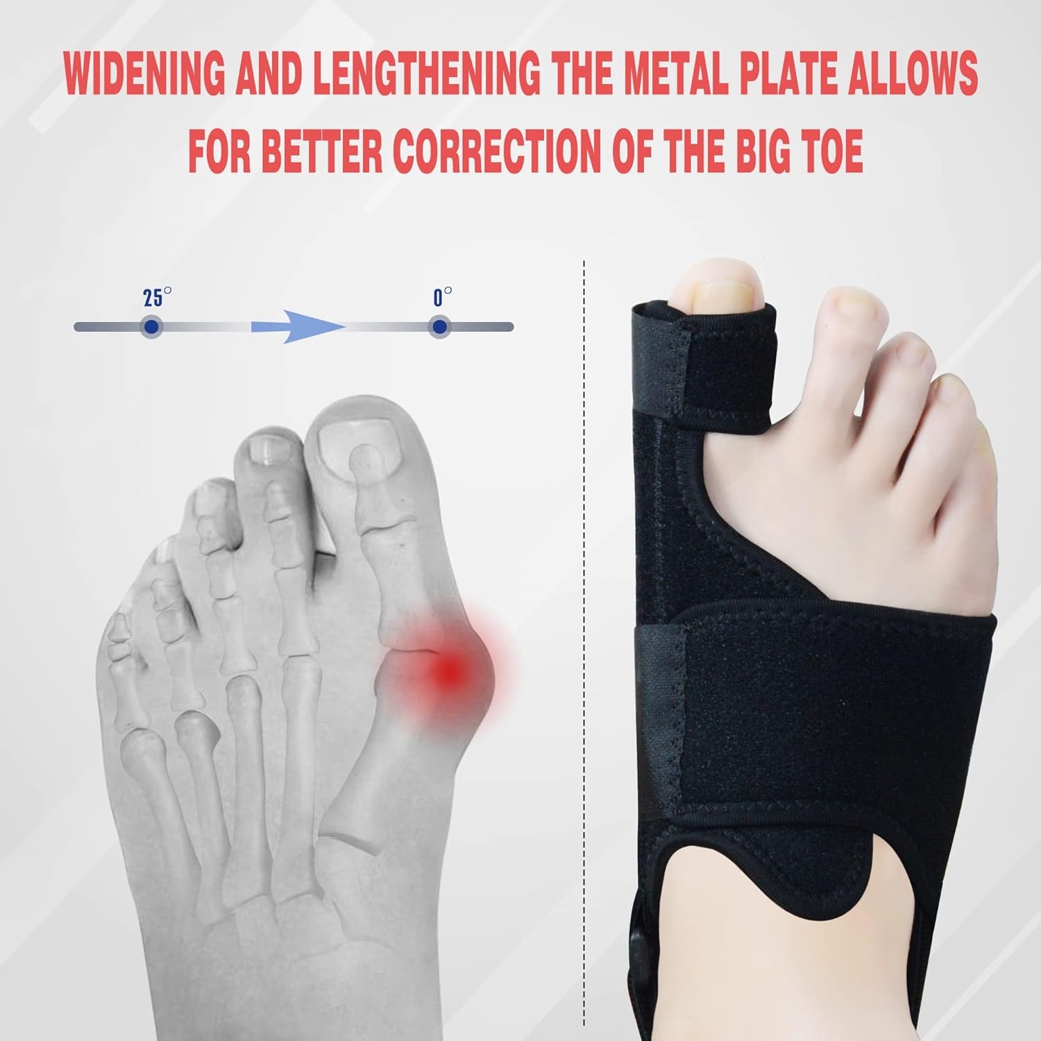 1 Pair Bunion Corrector for Women & Men, Night Splint, One Size, Black