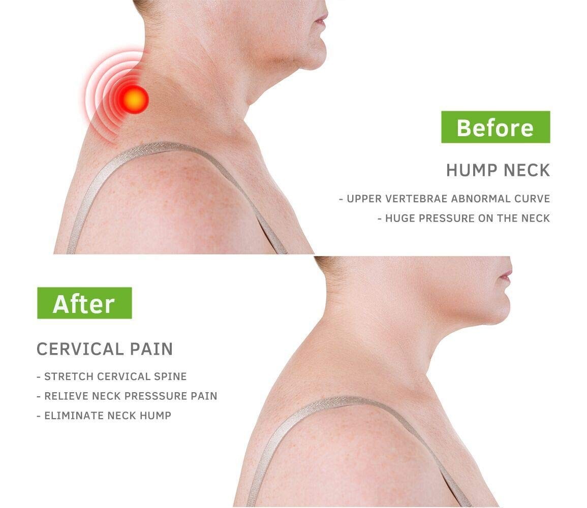 Upper Back Pain Relief, Headache Treatment, Costochondritis Support, Posture Cor