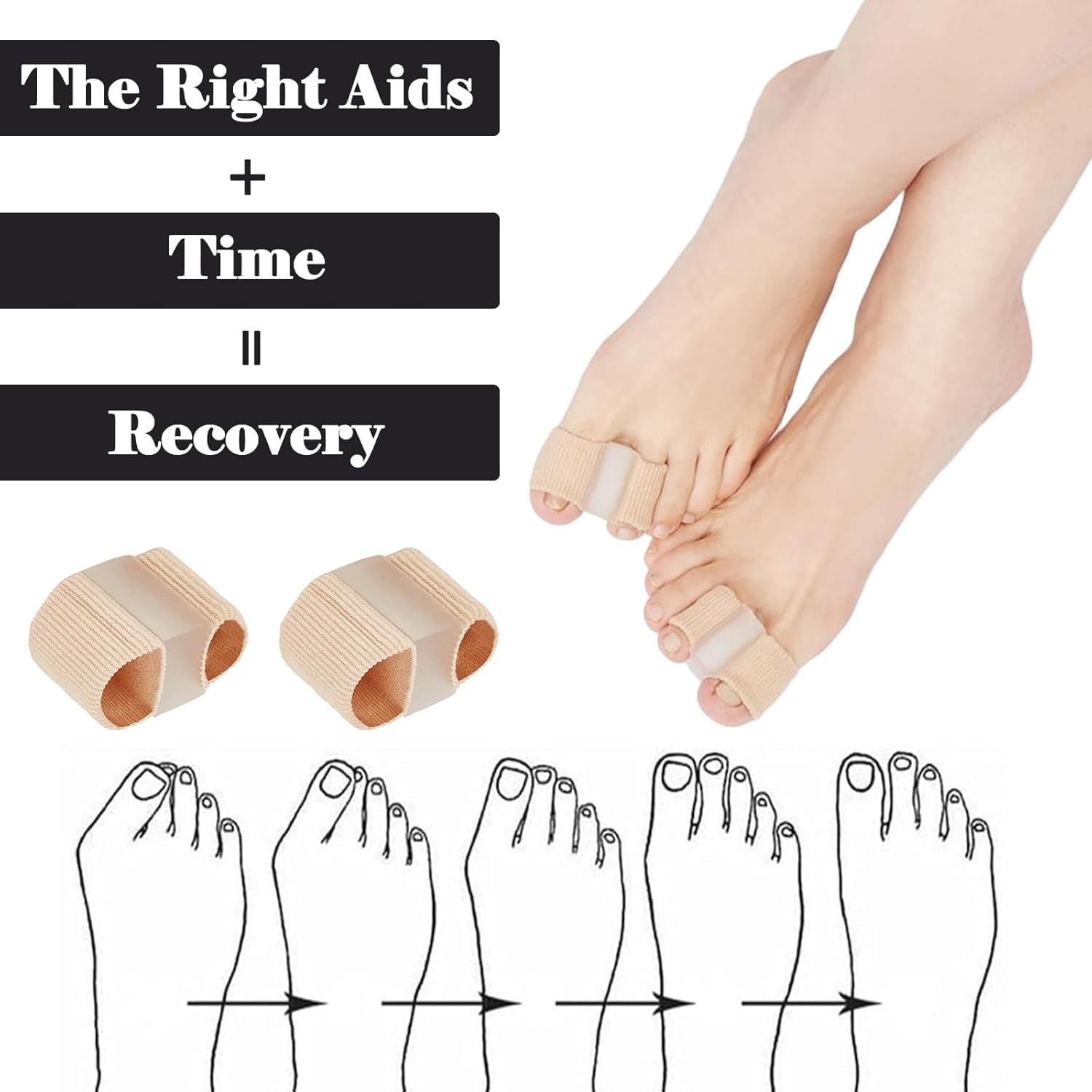 LUVINA Gel Toe Separators for Bunions & Hammer Toes – Breathable Fabric, 1L