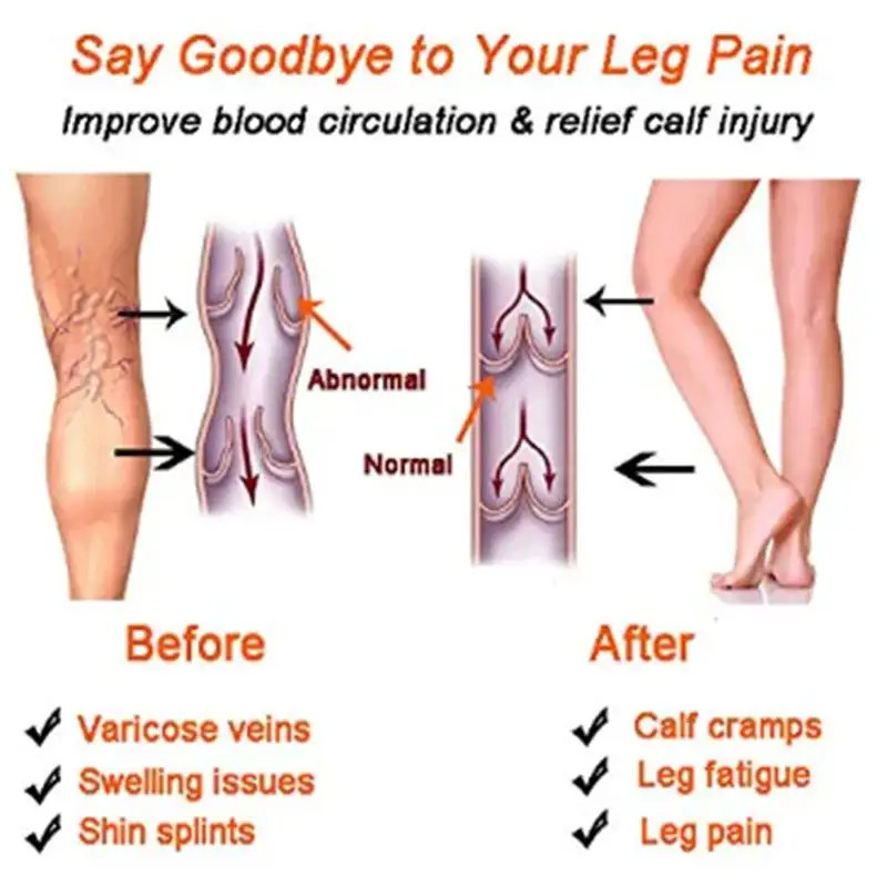Varicose Veins Compression Socks Fit For Golf Rugby Hiking Sports For Anti Fatig