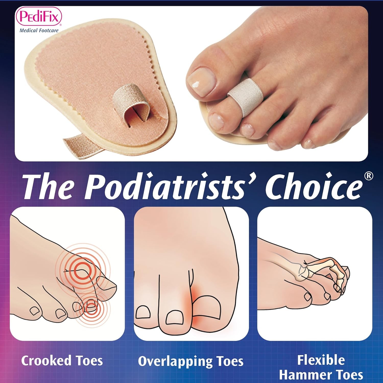 Pedifix Budin Toe Splint, Single Toe, OSFM