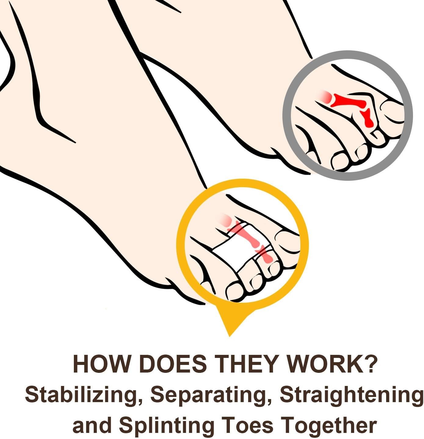 Welnove 6Pcs Hammer Toe Straightener, Splints, 6 Count (Pack of 1)