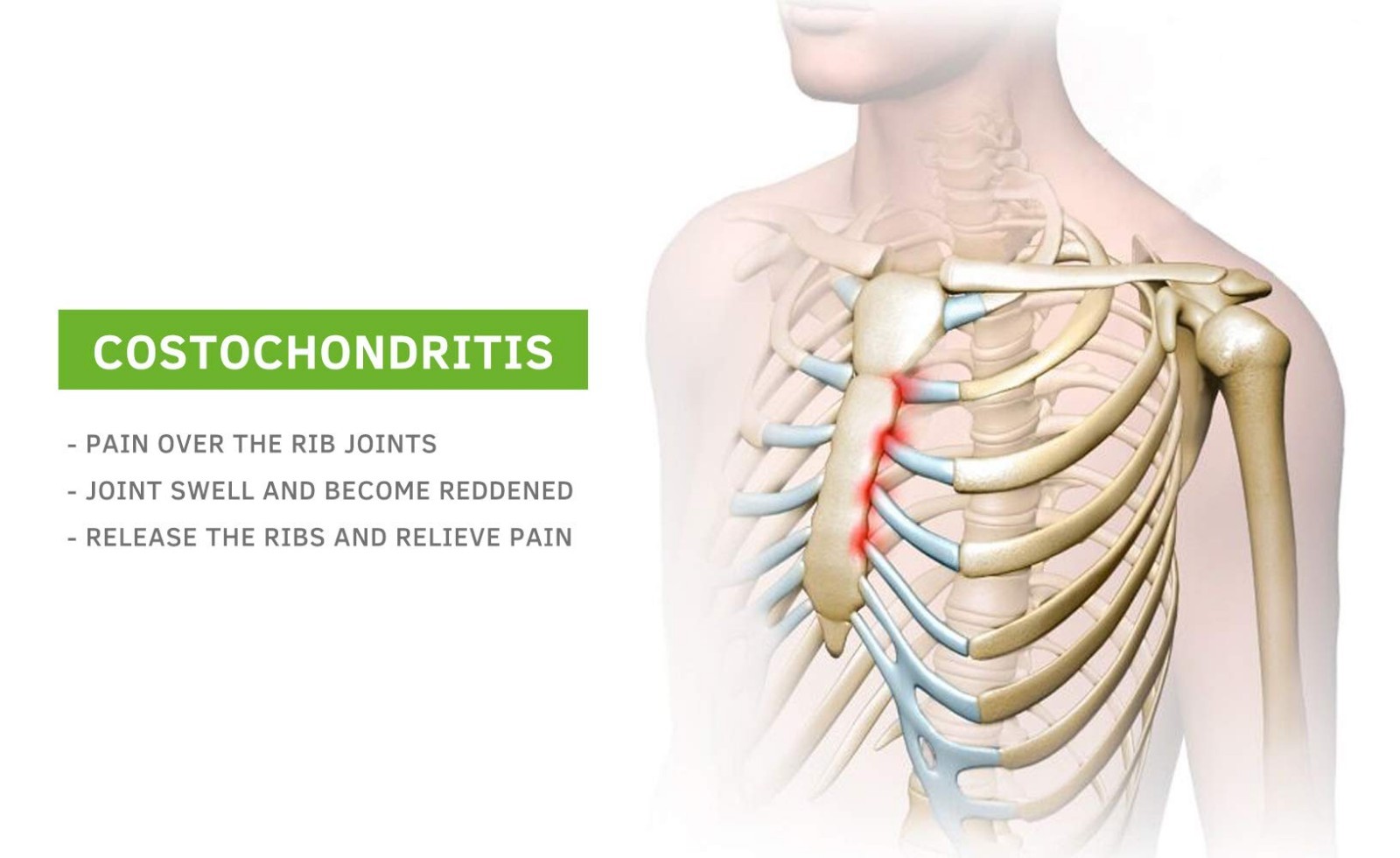Upper Back Pain Relief & Headache Treatment – Costochondritis & Tietze Syndrome