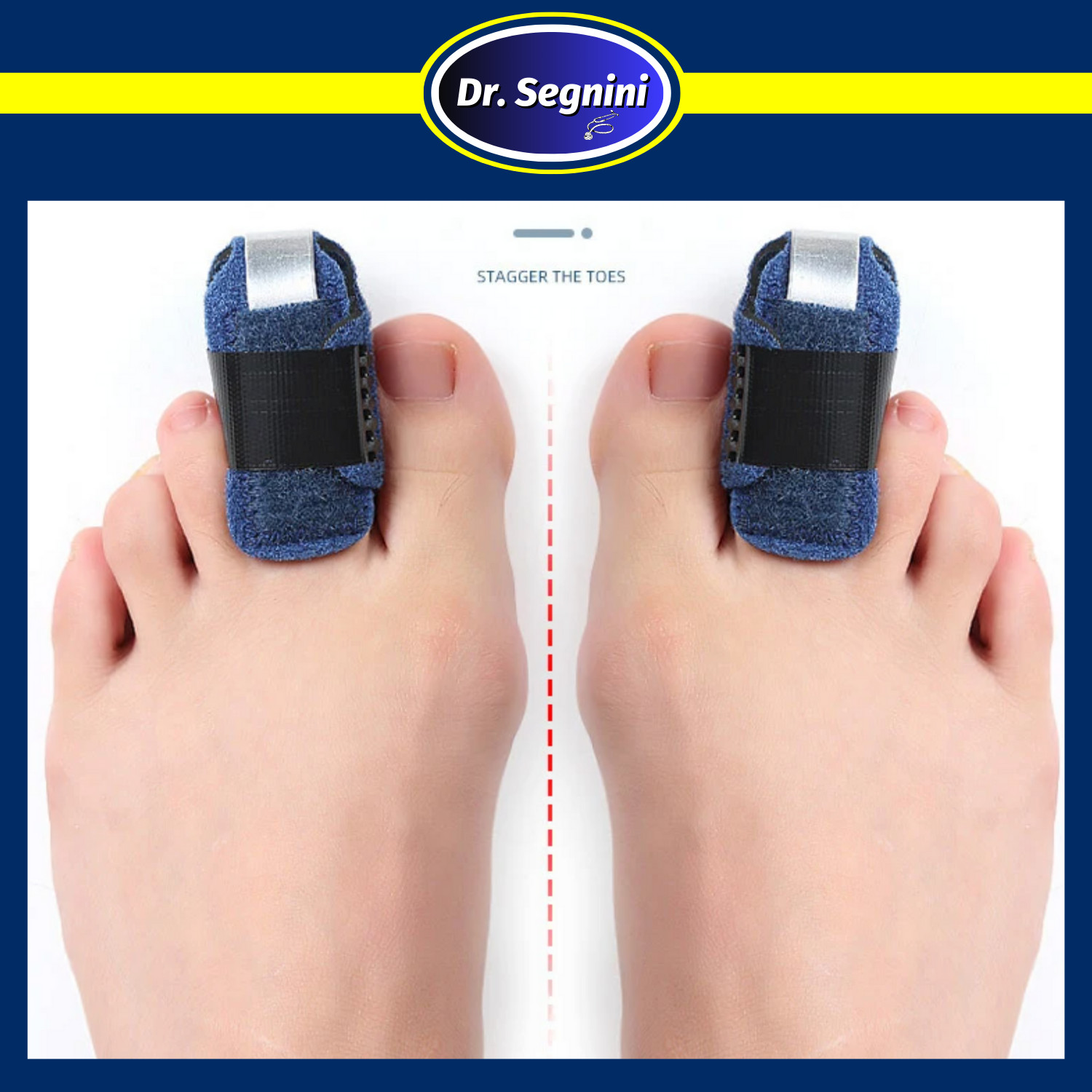 1 Pcs Toe Corrector Adjustable Splint Straightener Brace Support