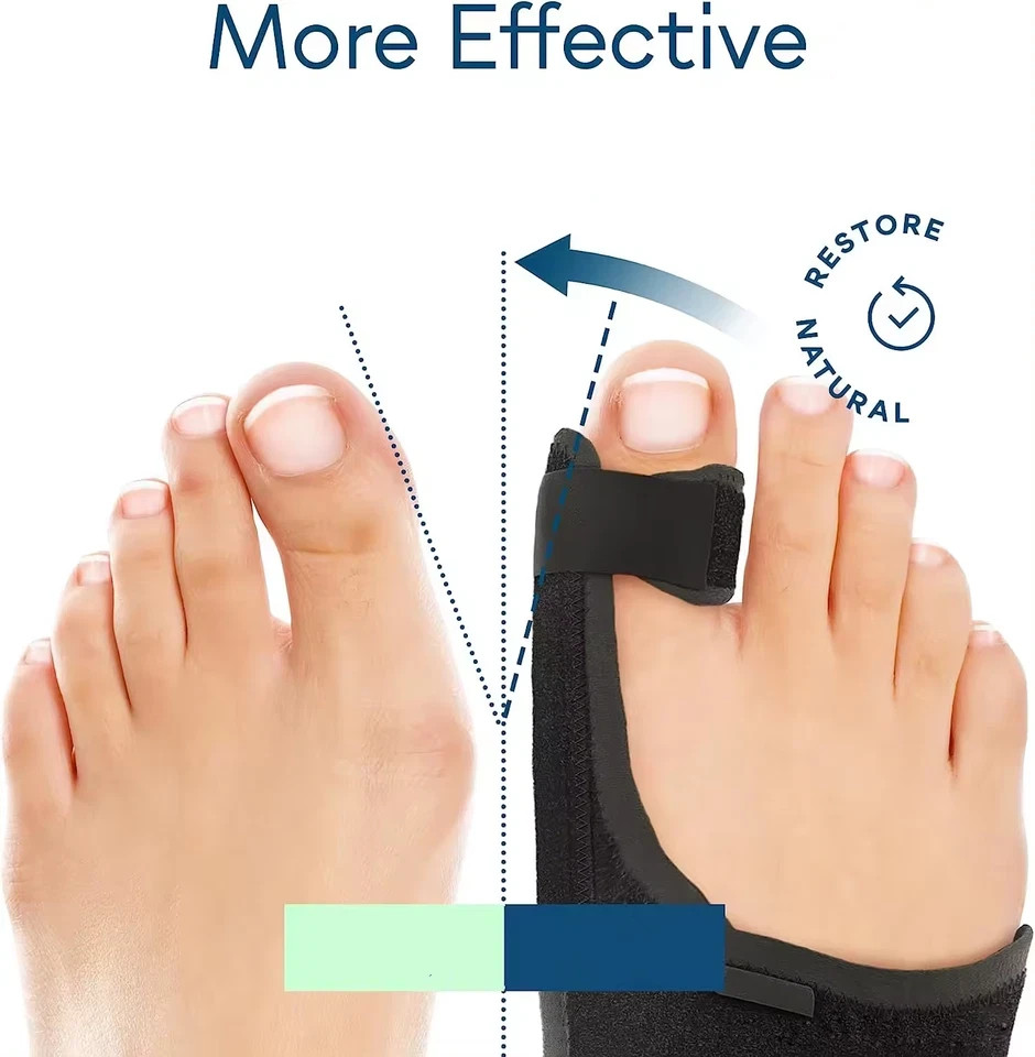 1 Pair Bunion Corrector Fix Hallux Valgus Adjustable Orthosis Women Men Splints