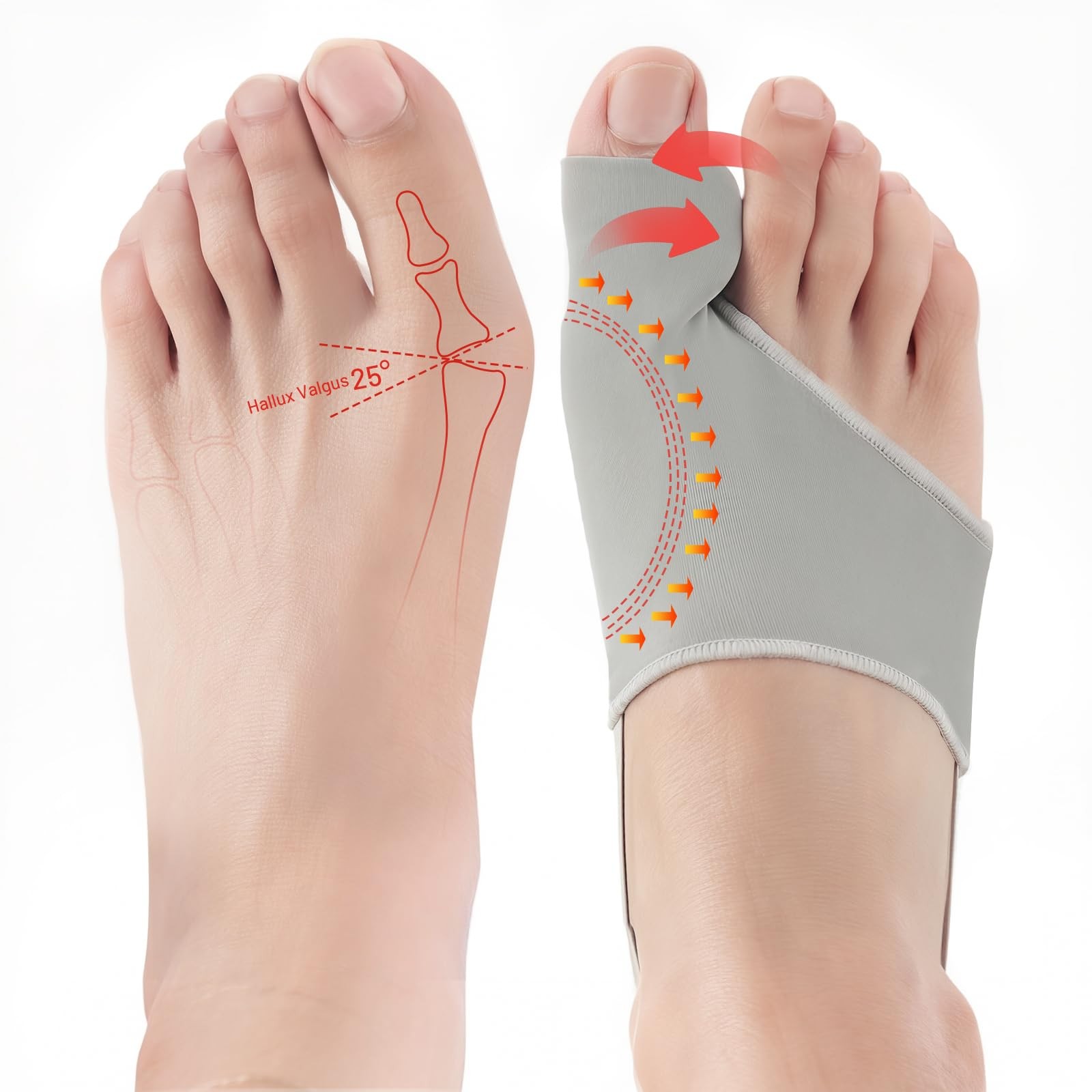 Swpcioc Bunion Corrector Gray 1pc
