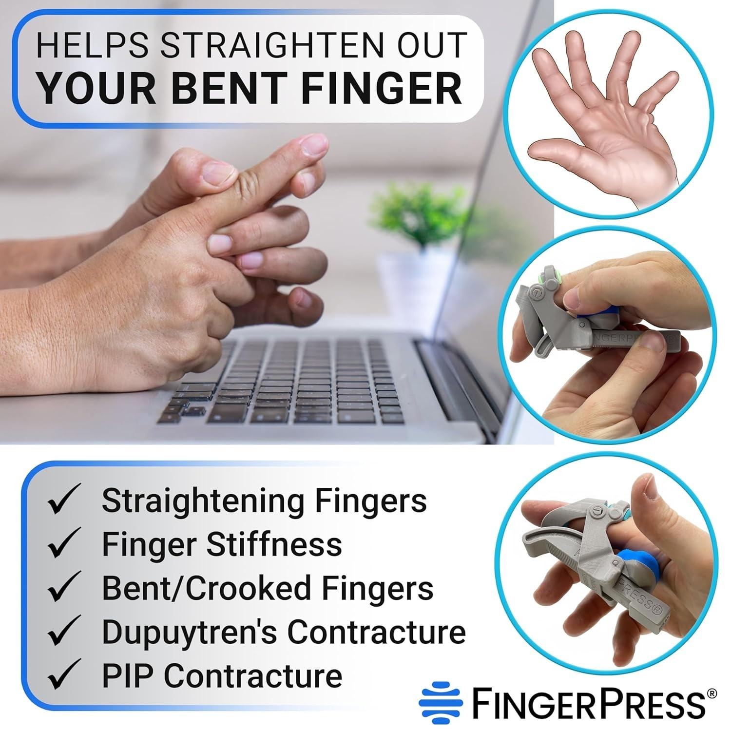 Innovative Finger Stretching Device | Flexible Joint Support