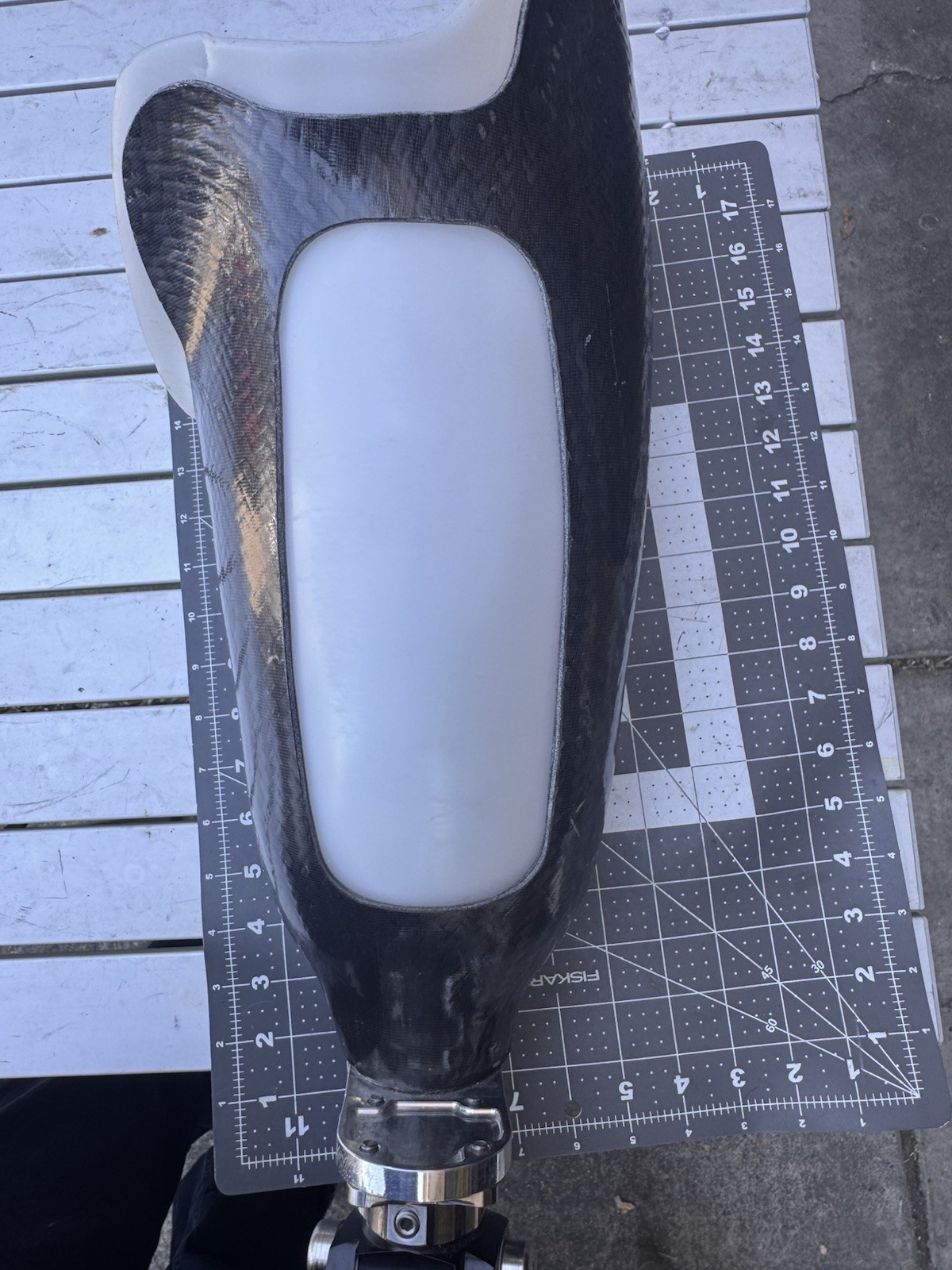 Complete Above-Knee Right Prosthetic Leg. Trulife, Ossure, Kiss, Lapoc/Swan