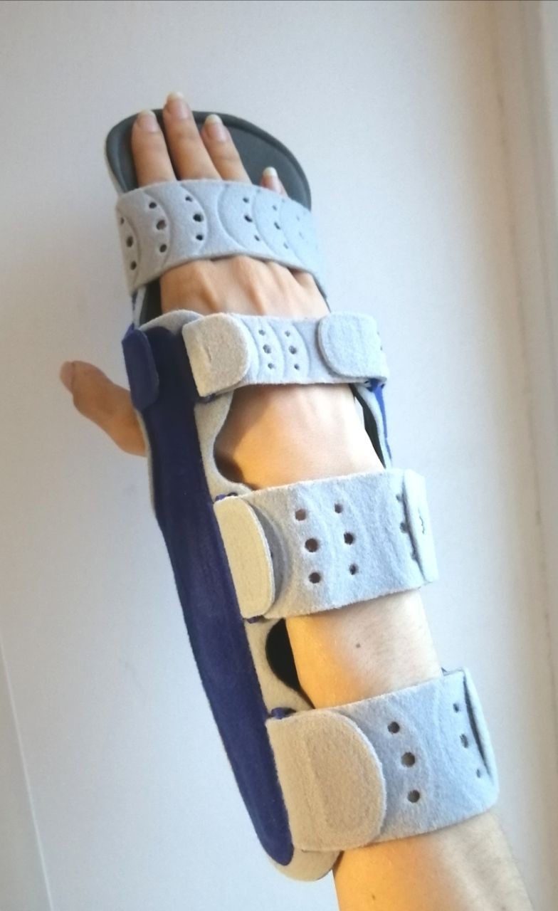 Bauerfeind ManuLoc Long Plus Hand Orthosis Immobilizing Size 3 L-XL