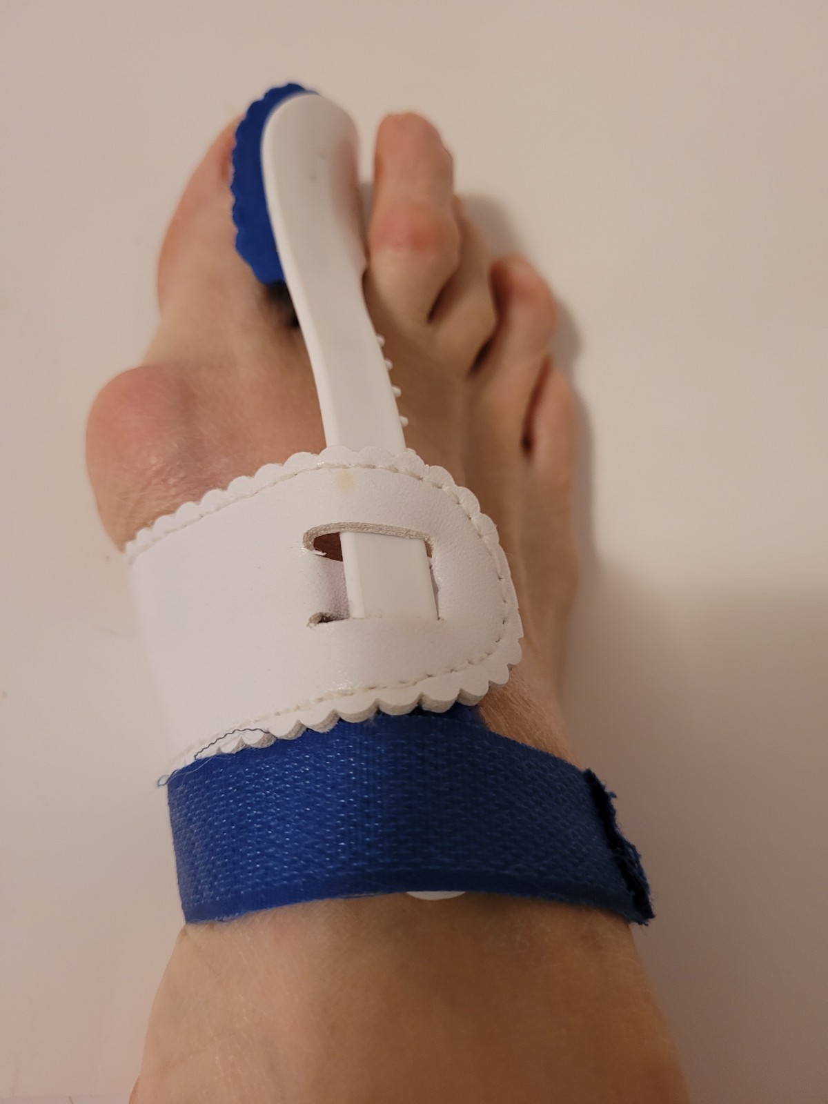 Toe Alignment Splint for Hallux Valgus, Hammer Toe