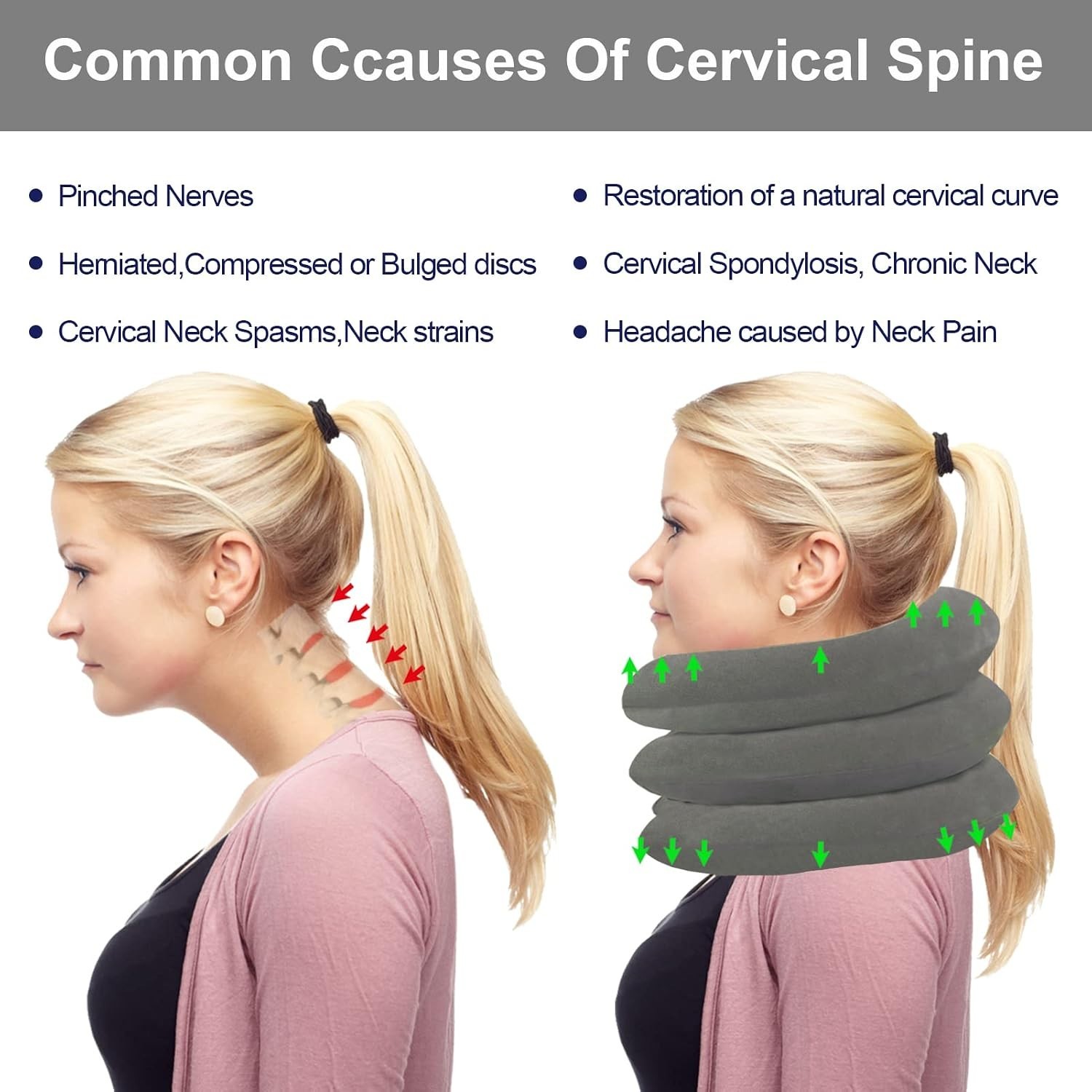 Cervical Neck Traction Device – Quick Inflation to Relieve Neck Pain & Improv…