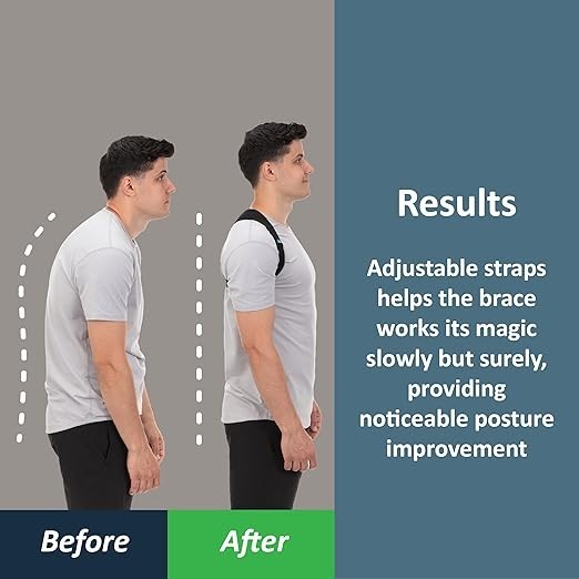 ComfyBrace Posture Corrector-Back Brace for Men and Women- Fully Adjustable
